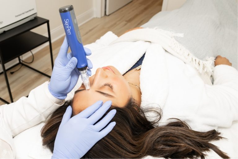 woman receiving skinpen microneedling treatment in elmhurst illinois