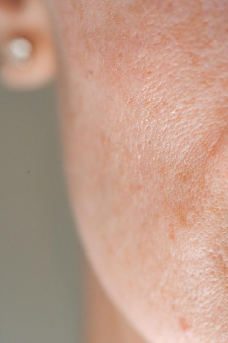 beautiful skin with pores and freckles