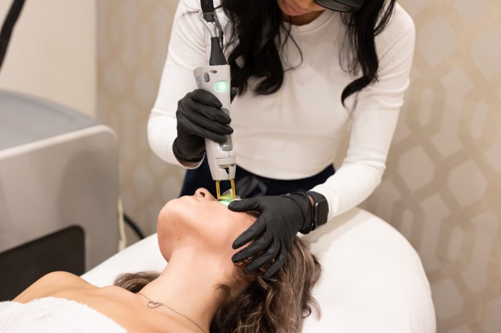 ipl photofacial treatment at Accelerated Aesthetics in elmhurst il